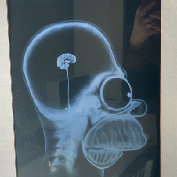 Homer Simpson XRay in picture frame - Picture 3 of 6